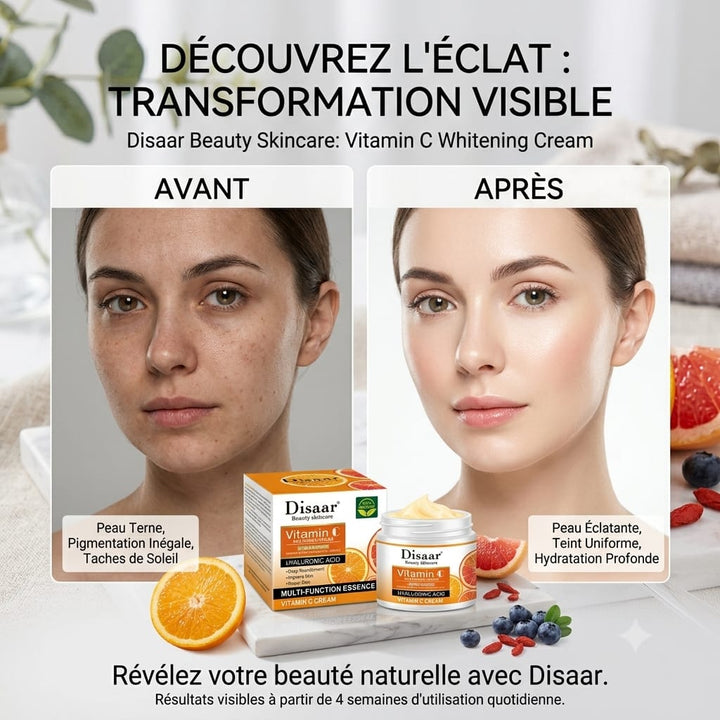 Crème Blanchissante Pour La Peau À La Vitamine C 50G - Crème Hydratante et Antitaches - Unifie et Illumine le Teint - Tous Types de Peaux